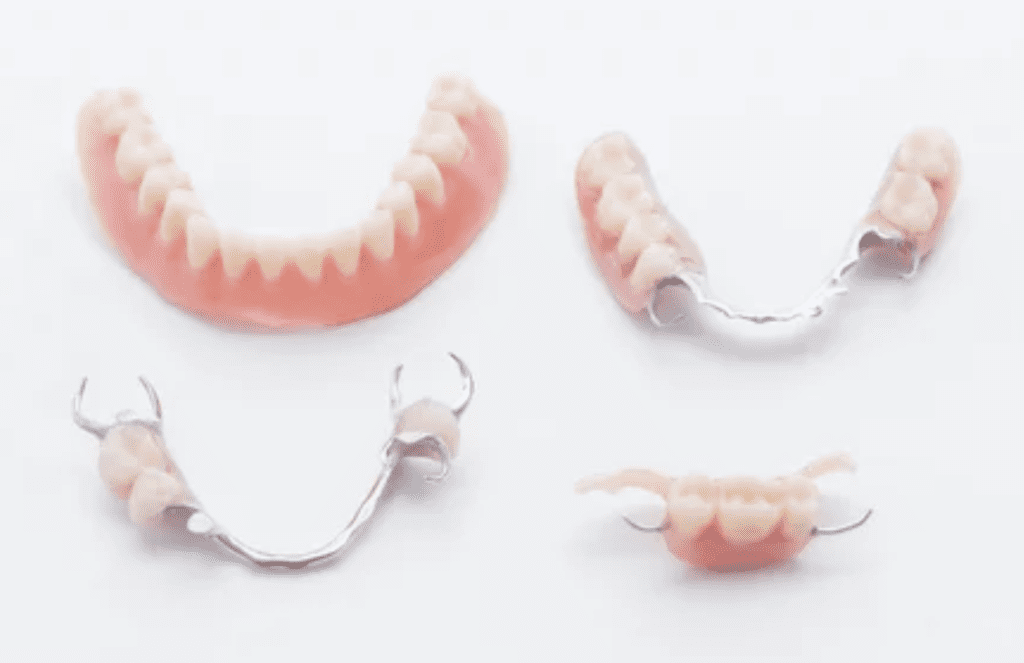 fixed partial dentures